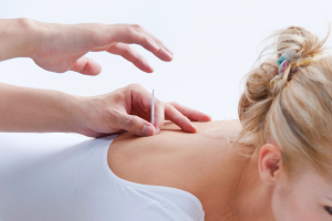 Acupuncture Benefits For Menopause